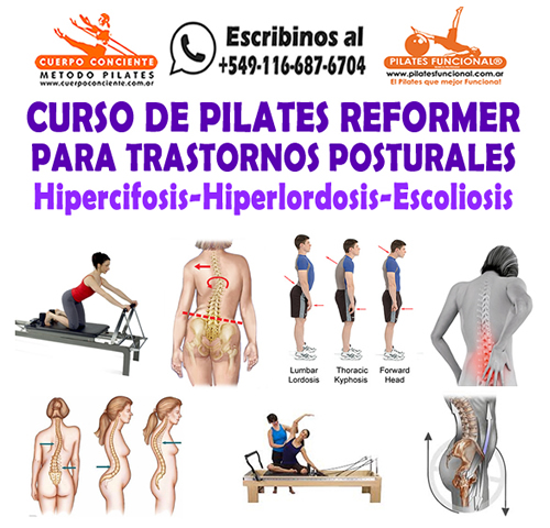 Curso de Pilates Reformer hipercifosis hiperlordosis y escoliosis