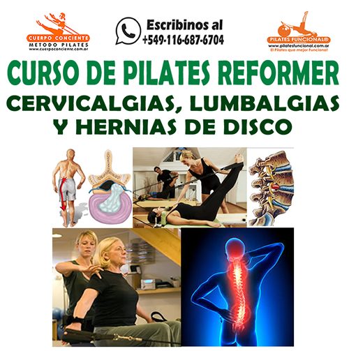 Caurdo de Pilates reformer cervicalgia lumbalgia hernias de disco